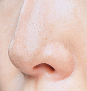 毛穴の奥まで汚れを落とす ビフォー